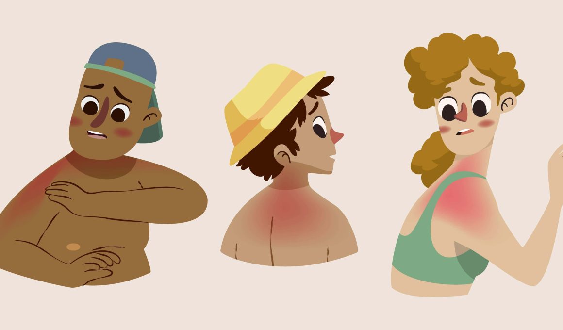 Cartoon illustration of people with sunburn