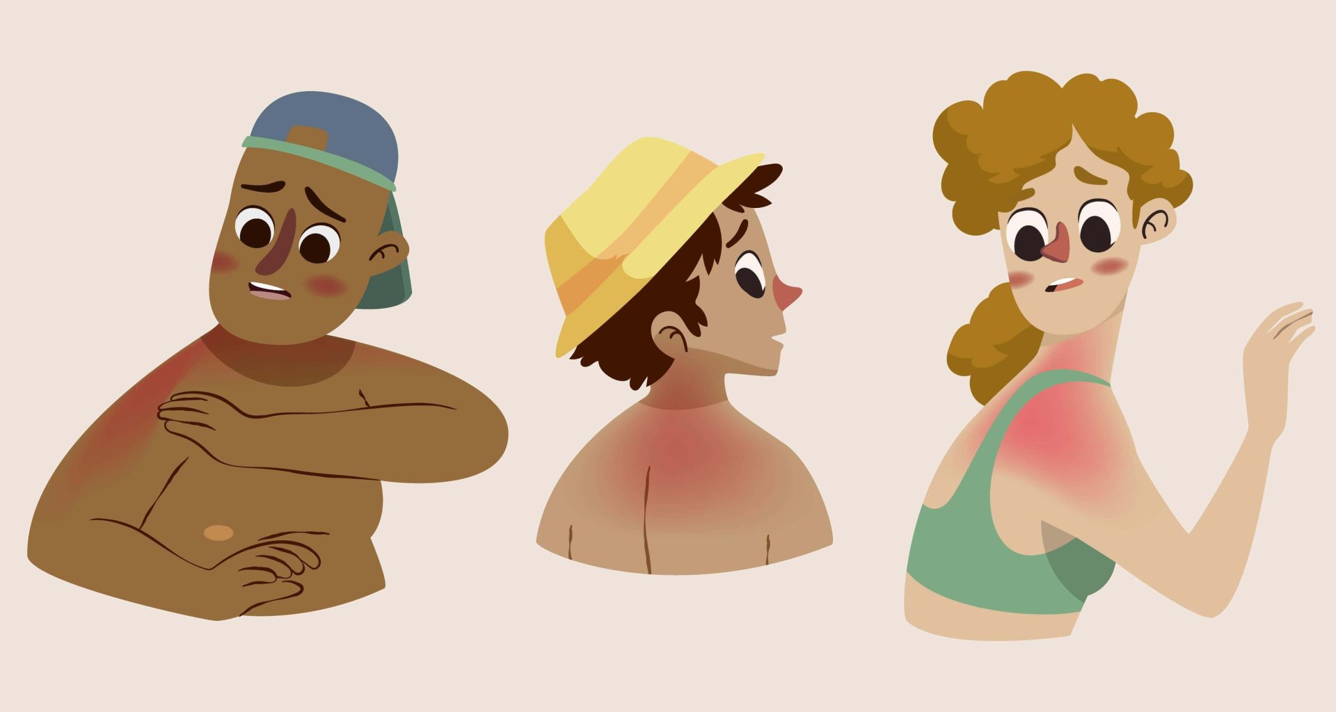 Cartoon illustration of people with sunburn